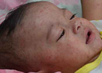 Image Credit: CDC Global, Jim Goodson, M.P.H. - Public domain/Wiki Commons
