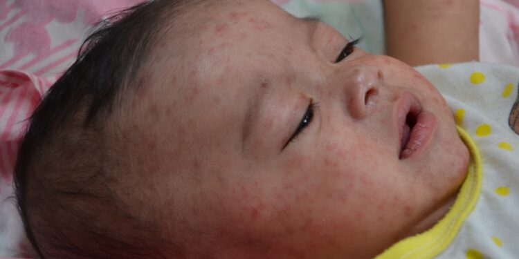 Image Credit: CDC Global, Jim Goodson, M.P.H. - Public domain/Wiki Commons